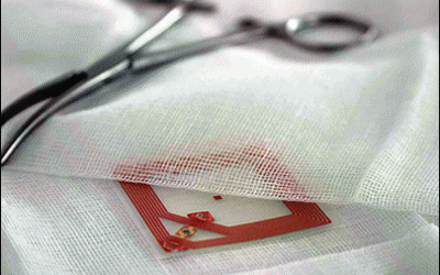 Siemens Launches RFID Pilot to Track Surgical Sponges, Procedures