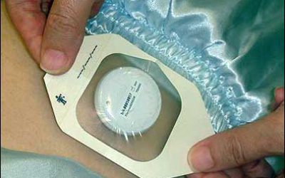 Tan Tock Seng Hospital Uses RFID to Take Patient Temperatures