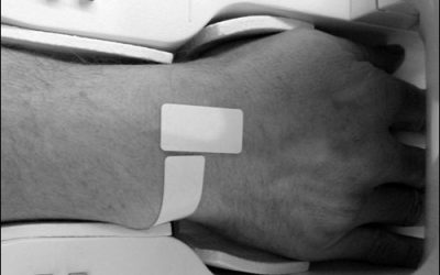 Swiss Study Finds RFID Tags Safe for MRI, CT Scans