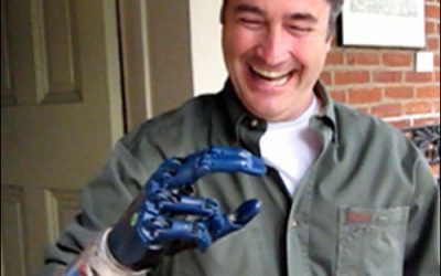 Most Innovative Use of RFID: RFID Helps Amputees Manipulate Prosthetic Hands