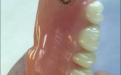 RFID to Track Dentures at Nursing Homes