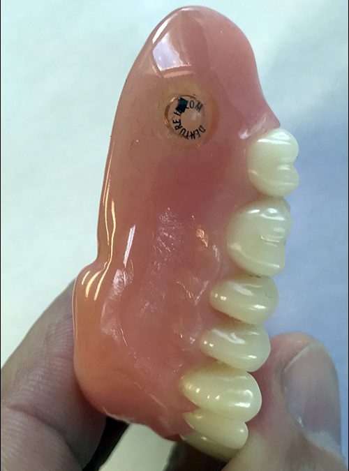 RFID to Track Dentures at Nursing Homes