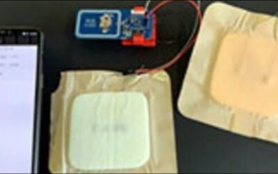 Smart Bandages Measure Wound Healing via RFID