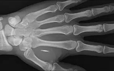 RFID Surveillance Less Threat than Perception