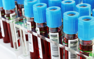 Thermo Fisher Relies on CYBRA’s RFID Tracking, Alerting System